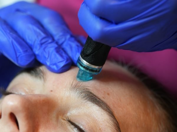 HydraFacial Near Me in NYC
