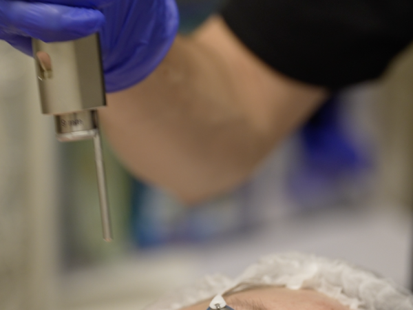 Instant Face Lift Laser Facial